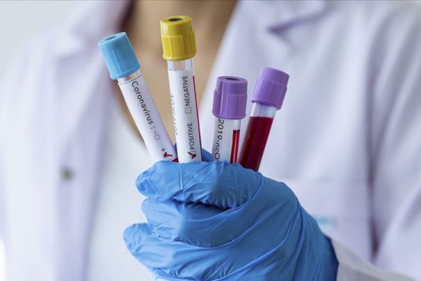 Yeni Varyant: COVID-19 ve Omicron’dan Ayrı Bir Tehdit Geliyor