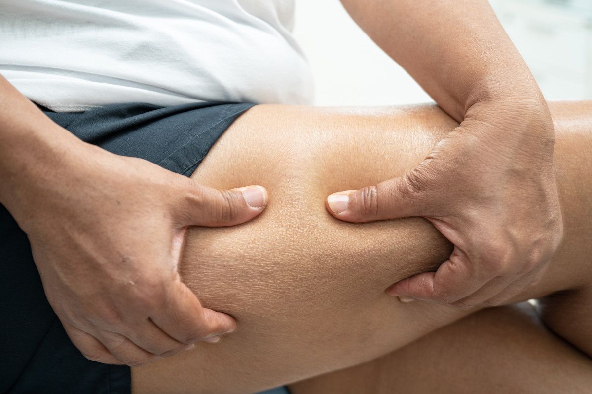 Cildinizi Sıkılaştıran ve Selülitle Mücadele Eden Besin Tavsiyeleri