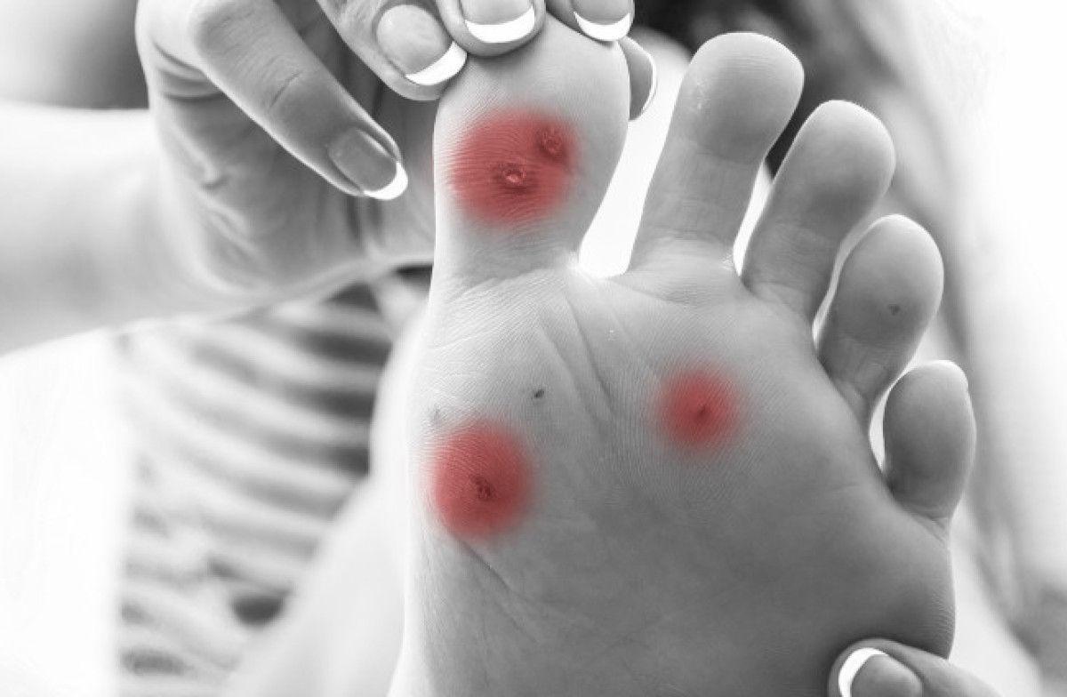 Sigara İçenler İçin Uyarı: Sinsi İlerleyen ve Doku Kaybına Yol Açan Hastalık